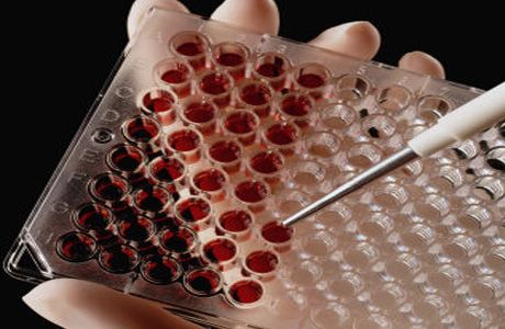 Penularan HIV melalui hubungan heteroseksual: penemuan baru