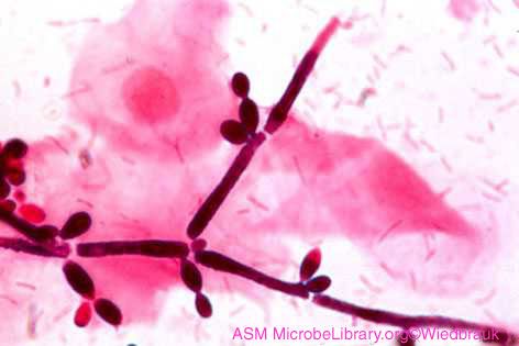 Jamur Candida (Candida) - Agen penyebab kandidiasis