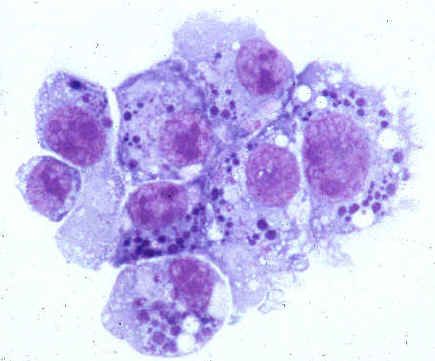 Patogen manusia anaplasmosis (keluarga Anaplasmataceae)