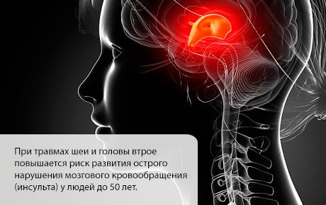 Risiko stroke meningkat pada bulan-bulan pertama setelah cedera kepala atau leher