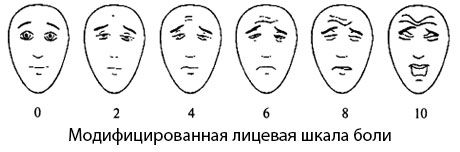 Modifikasi Facial Pain Scale
